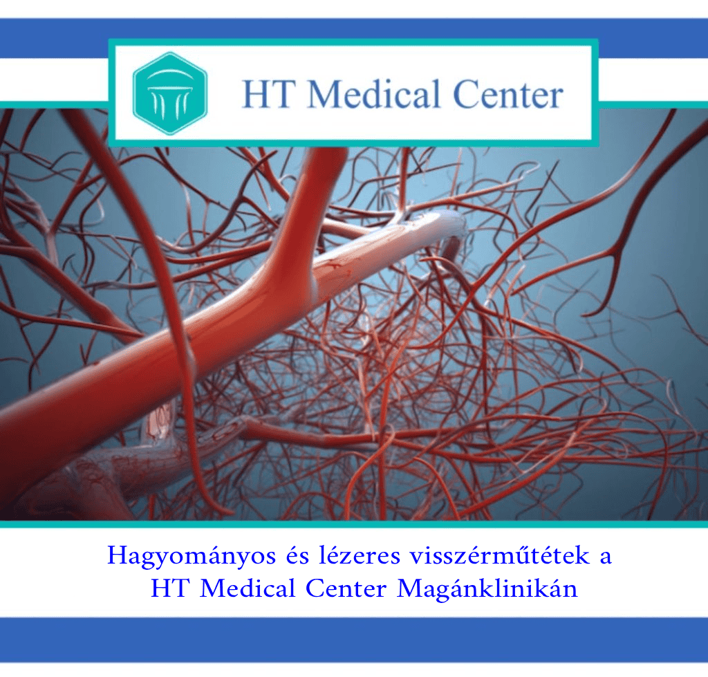 Érsebészeti műtétek - HT Medical Center